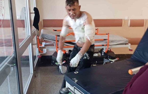 Engelli vatandaşa dehşeti yaşattı: Telefonunu çaldı, şikayet edince benzin döküp yaktı