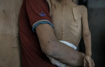 İsrail’in kıtlığı dayattığı Gazze’de açlıktan ölenlerin sayısı 269’a çıktı