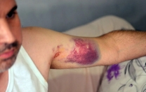 Dayıdan yeğenine miras saldırısı: Kadına miras yok!