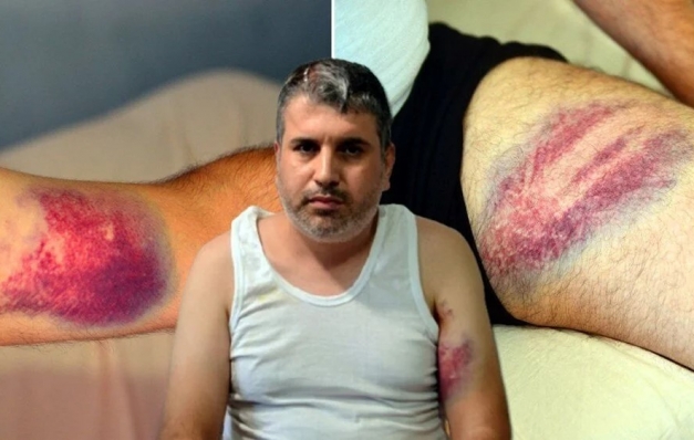 Dayıdan yeğenine miras saldırısı: Kadına miras yok!